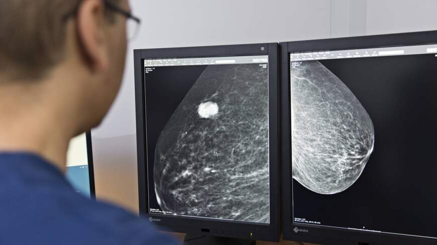 En person kigger på en scanning af et bryst.